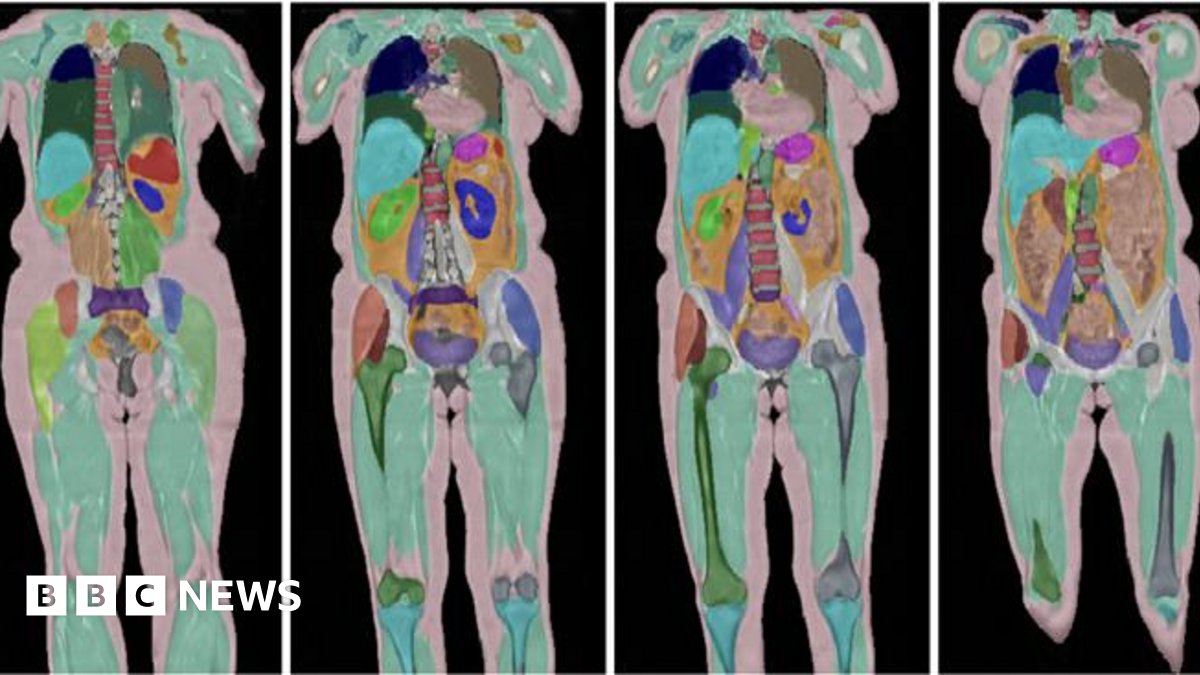 100,000 UK Volunteers Contribute To Massive Human Imaging Study 100,000 UK Volunteers Contribute To Massive Human Imaging Study