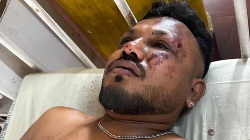 Air India Crash Sole Survivor: Vishwash Kumar Ramesh's Miraculous Escape From Seat 11A Air India Crash Sole Survivor: Vishwash Kumar Ramesh's Miraculous Escape From Seat 11A