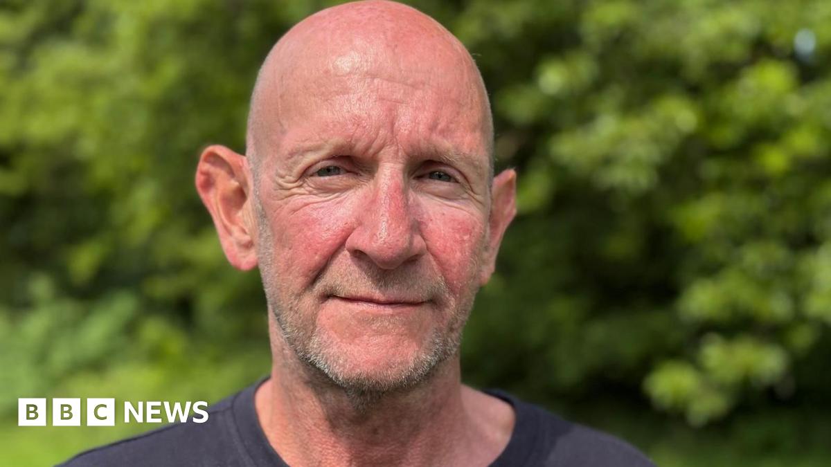Alcohol's Hidden Toll: Brain Damage Affecting Thousands, Expert Says Alcohol's Hidden Toll: Brain Damage Affecting Thousands, Expert Says