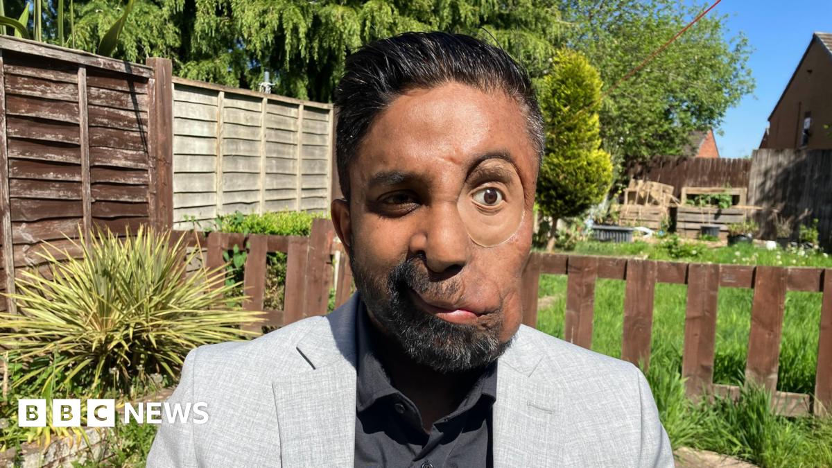 Denied Service Because Of My Face: Sharing My Experience With Facial Disfigurement Denied Service Because Of My Face: Sharing My Experience With Facial Disfigurement