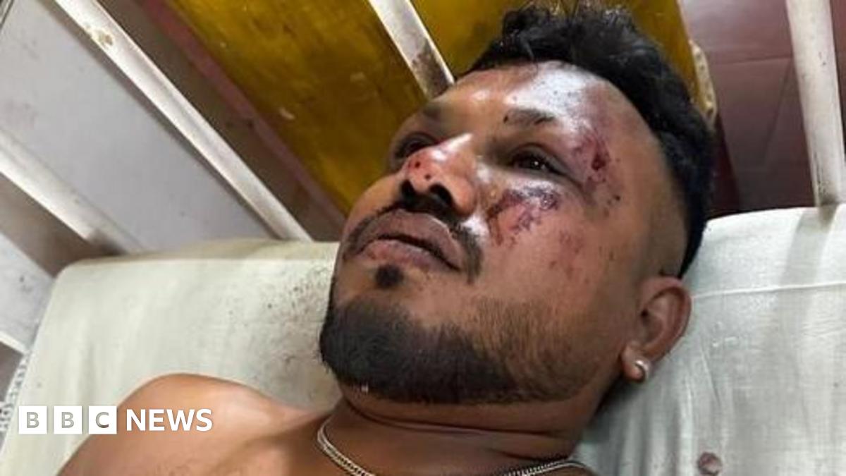 From Seat 11A To Safety: British Passenger's Tale Of India Plane Crash Survival From Seat 11A To Safety: British Passenger's Tale Of India Plane Crash Survival