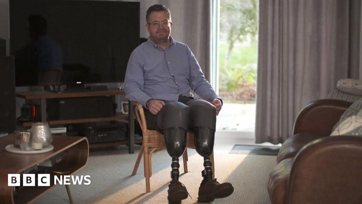 Investigation Launched: Truro Surgeon Accused Of Fraudulent Leg Amputations Investigation Launched: Truro Surgeon Accused Of Fraudulent Leg Amputations