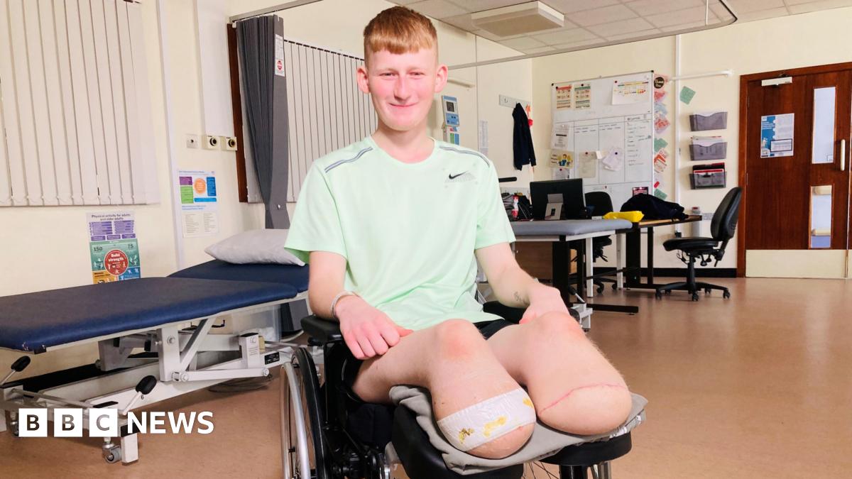 Legless Teen Holds Driver Accountable For Devastating Accident Legless Teen Holds Driver Accountable For Devastating Accident