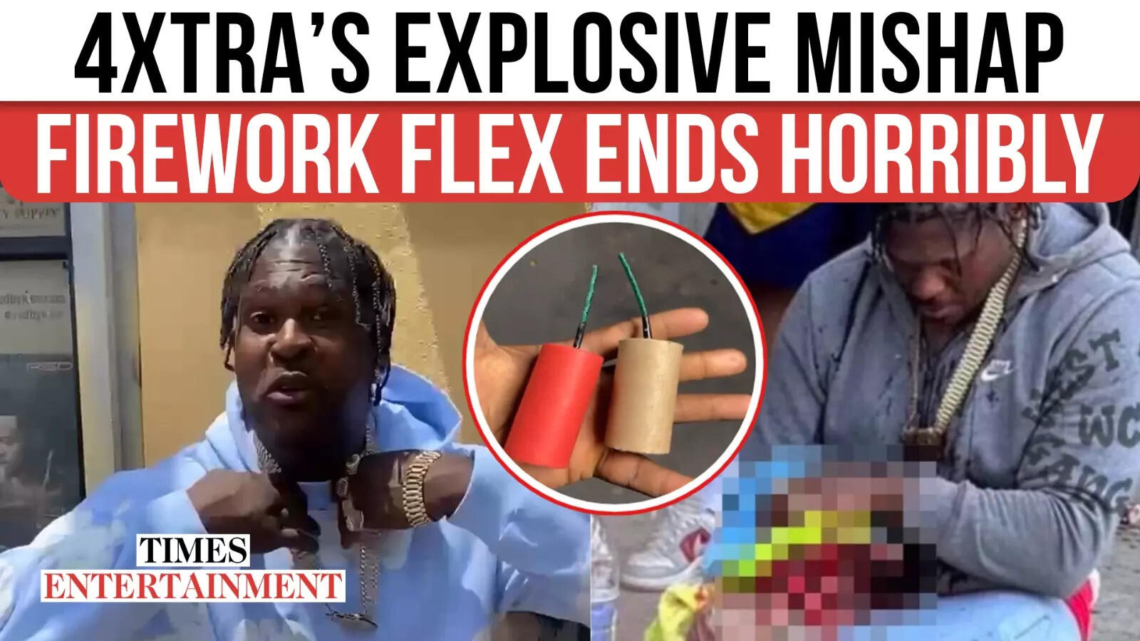 Rapper's Hand Severely Injured In 4Xtra Firework Accident Rapper's Hand Severely Injured In 4Xtra Firework Accident