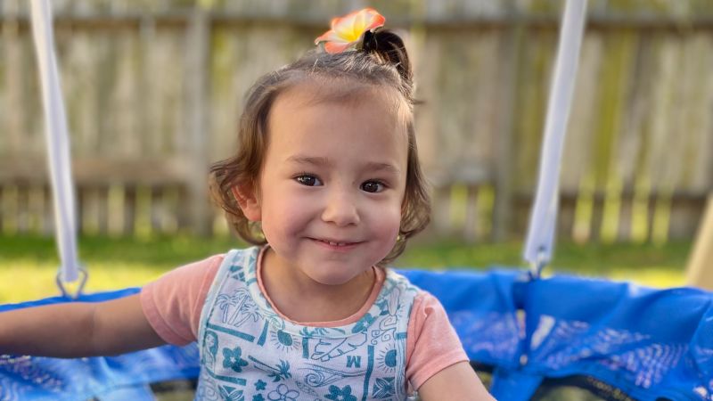 Texas Baby's Journey: From Preemie Wound To Healing With Fish Skin Texas Baby's Journey: From Preemie Wound To Healing With Fish Skin