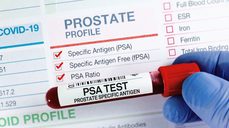 Understanding Prostate Cancer: Key Insights From Dr. Sanjay Gupta Understanding Prostate Cancer: Key Insights From Dr. Sanjay Gupta